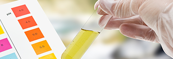 Chromatographie Chromatographie