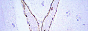 Anticorps primaires pour Western Blot